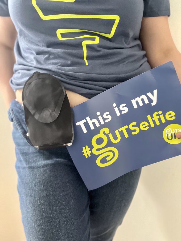 A person is standing and holding a blue sign that reads "This is my #GUTSelfie" with the Guts UK logo on it. They are wearing a grey t-shirt with a large, bold yellow question mark and a pair of blue jeans. The image prominently shows an ostomy bag attached to their abdomen, partially visible where the shirt is lifted. The photo is a proud and empowering representation related to digestive health awareness and advocacy.